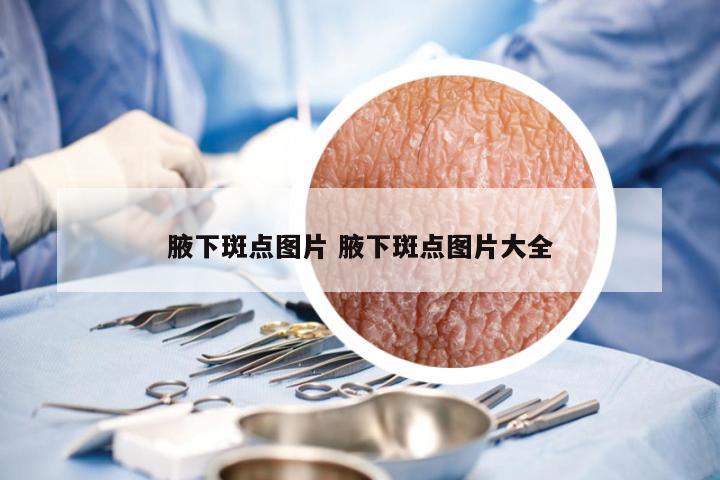 腋下斑点图片 腋下斑点图片大全