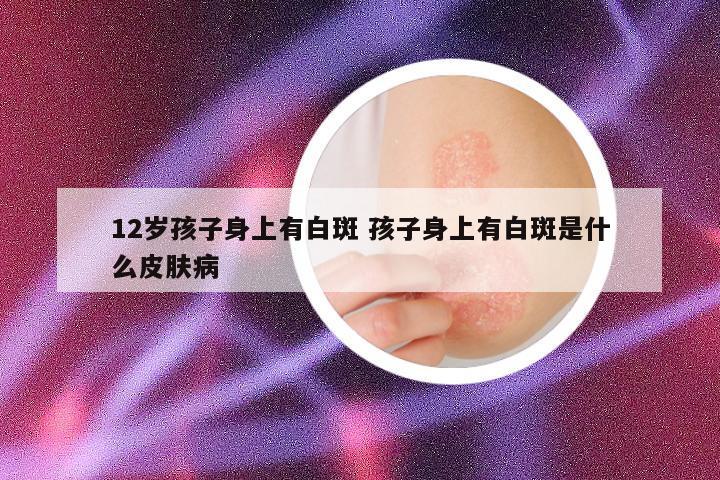 12岁孩子身上有白斑 孩子身上有白斑是什么皮肤病