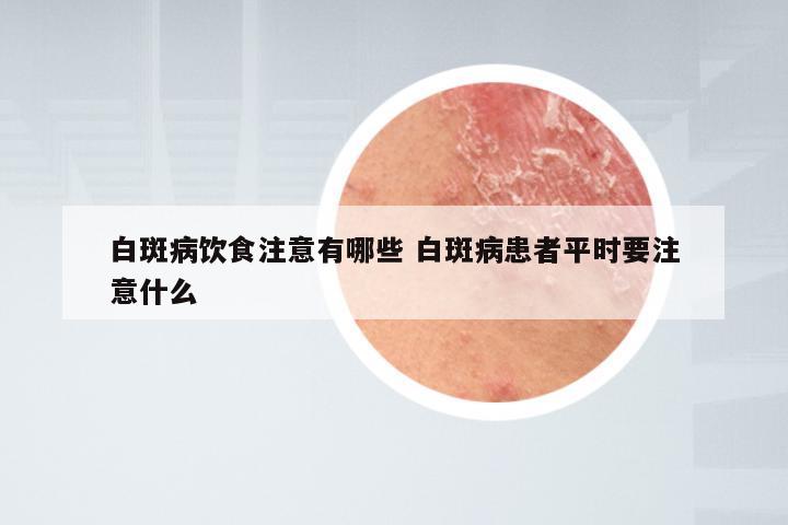 白斑病饮食注意有哪些 白斑病患者平时要注意什么