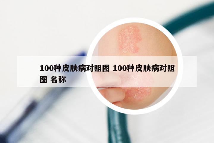 100种皮肤病对照图 100种皮肤病对照图 名称