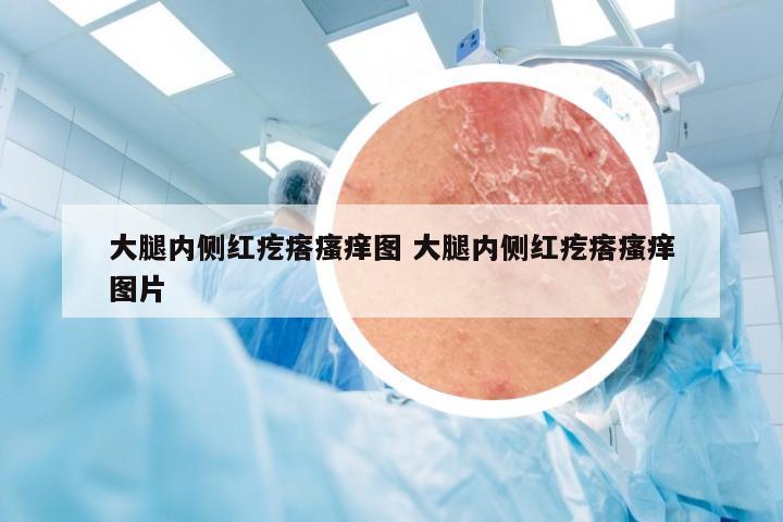 大腿内侧红疙瘩瘙痒图 大腿内侧红疙瘩瘙痒图片