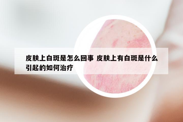 皮肤上白斑是怎么回事 皮肤上有白斑是什么引起的如何治疗