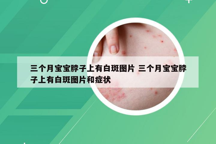 三个月宝宝脖子上有白斑图片 三个月宝宝脖子上有白斑图片和症状