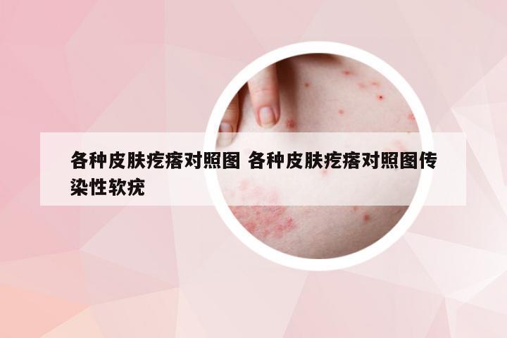 各种皮肤疙瘩对照图 各种皮肤疙瘩对照图传染性软疣