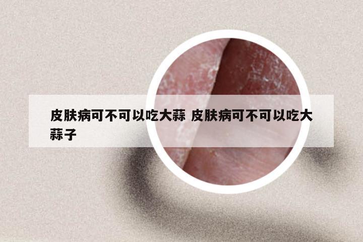 皮肤病可不可以吃大蒜 皮肤病可不可以吃大蒜子