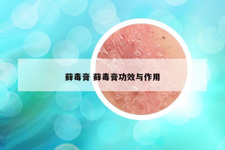 藓毒膏 藓毒膏功效与作用