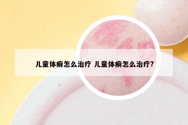 儿童体癣怎么治疗 儿童体癣怎么治疗?