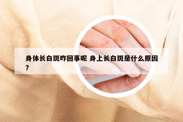 身体长白斑咋回事呢 身上长白斑是什么原因?