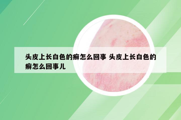 头皮上长白色的癣怎么回事 头皮上长白色的癣怎么回事儿