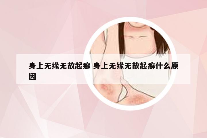 身上无缘无故起癣 身上无缘无故起癣什么原因