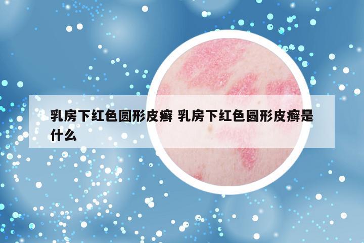 乳房下红色圆形皮癣 乳房下红色圆形皮癣是什么