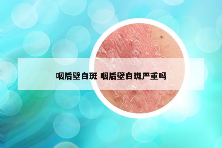 咽后壁白斑 咽后壁白斑严重吗