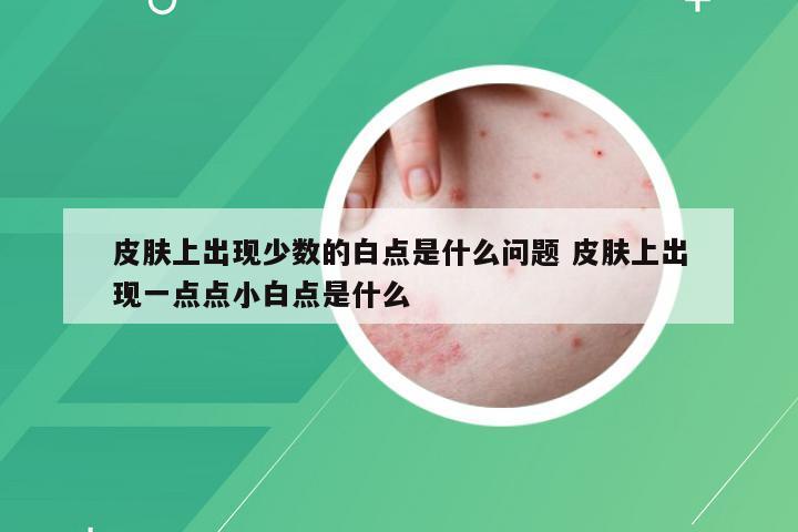 皮肤上出现少数的白点是什么问题 皮肤上出现一点点小白点是什么