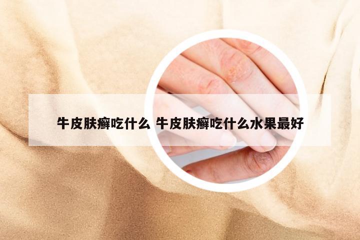 牛皮肤癣吃什么 牛皮肤癣吃什么水果最好