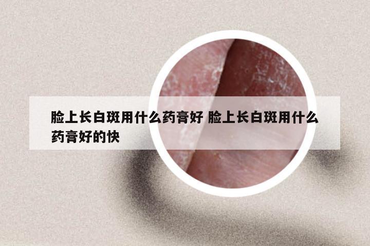 脸上长白斑用什么药膏好 脸上长白斑用什么药膏好的快