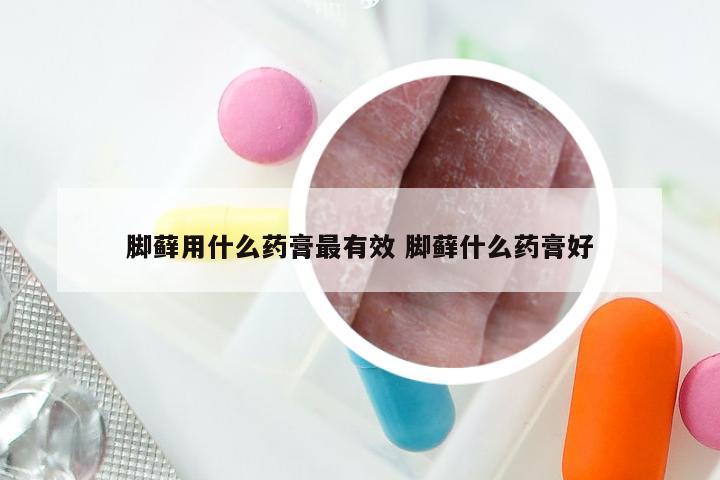 脚藓用什么药膏最有效 脚藓什么药膏好