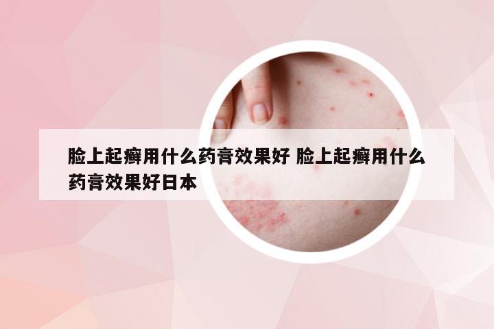 脸上起癣用什么药膏效果好 脸上起癣用什么药膏效果好日本