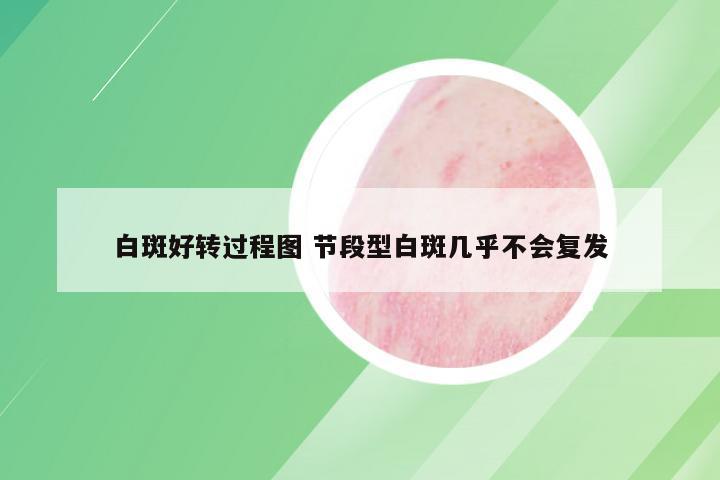 白斑好转过程图 节段型白斑几乎不会复发