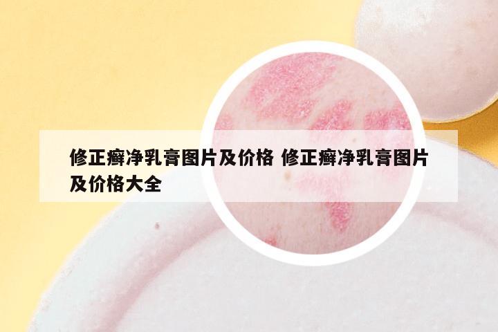 修正癣净乳膏图片及价格 修正癣净乳膏图片及价格大全