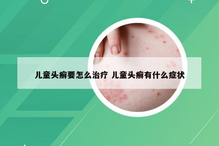 儿童头癣要怎么治疗 儿童头癣有什么症状