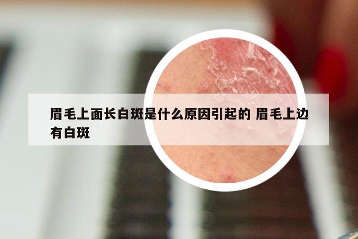 眉毛上面长白斑是什么原因引起的 眉毛上边有白斑