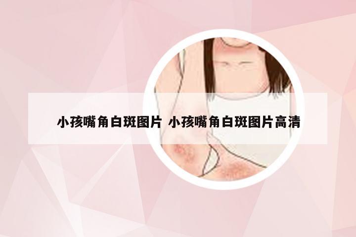 小孩嘴角白斑图片 小孩嘴角白斑图片高清