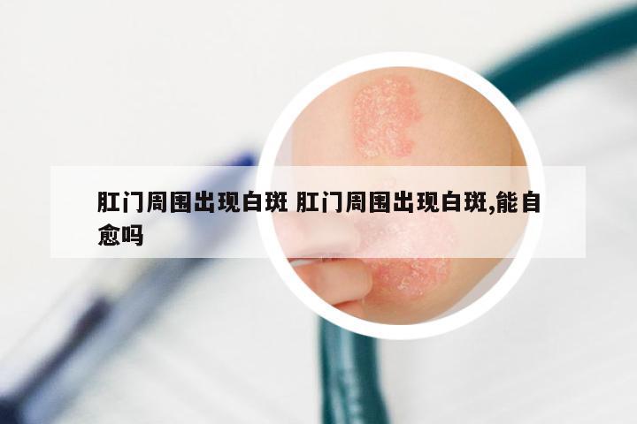 肛门周围出现白斑 肛门周围出现白斑,能自愈吗