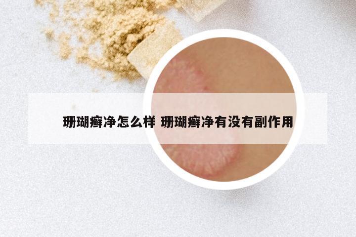 珊瑚癣净怎么样 珊瑚癣净有没有副作用