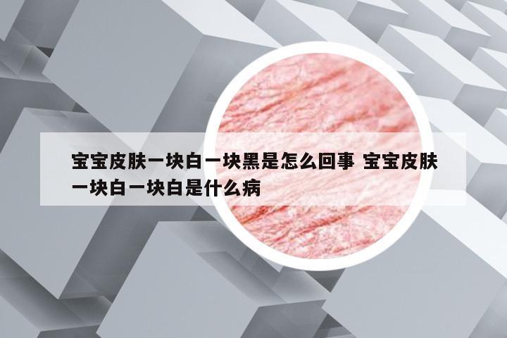 宝宝皮肤一块白一块黑是怎么回事 宝宝皮肤一块白一块白是什么病