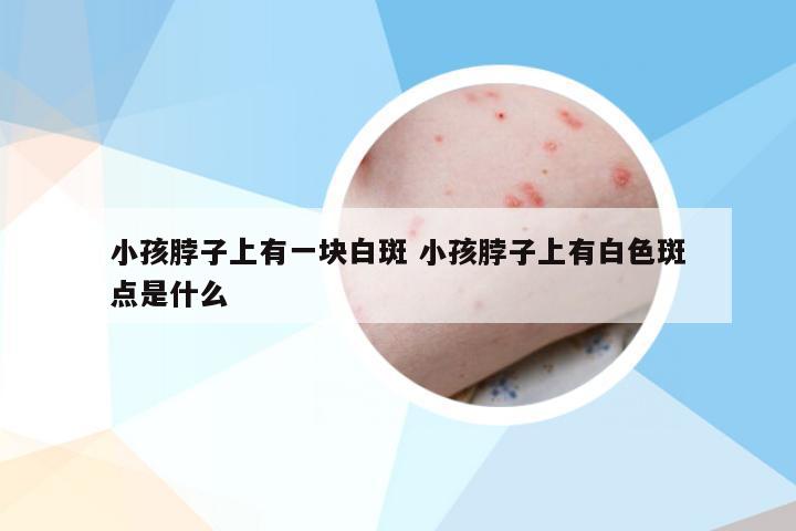 小孩脖子上有一块白斑 小孩脖子上有白色斑点是什么