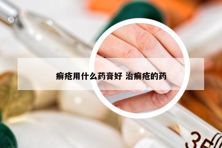 癣疮用什么药膏好 治癣疮的药