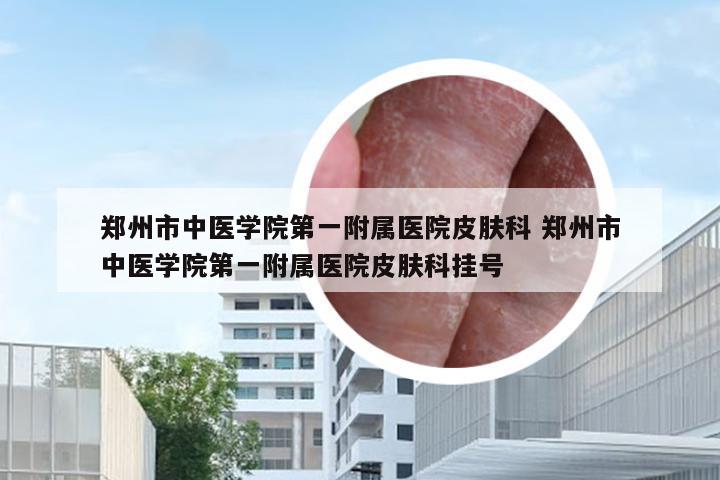 郑州市中医学院第一附属医院皮肤科 郑州市中医学院第一附属医院皮肤科挂号