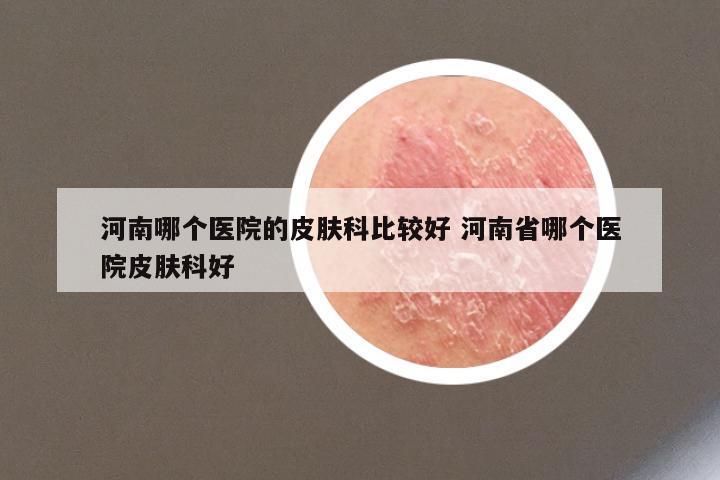 河南哪个医院的皮肤科比较好 河南省哪个医院皮肤科好