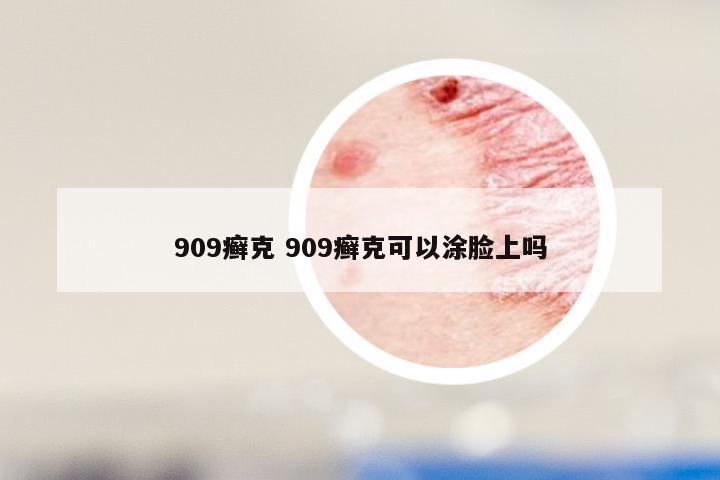 909癣克 909癣克可以涂脸上吗