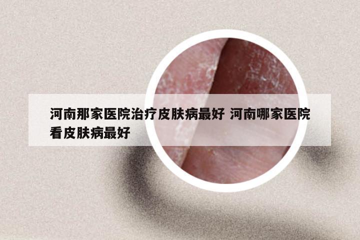 河南那家医院治疗皮肤病最好 河南哪家医院看皮肤病最好