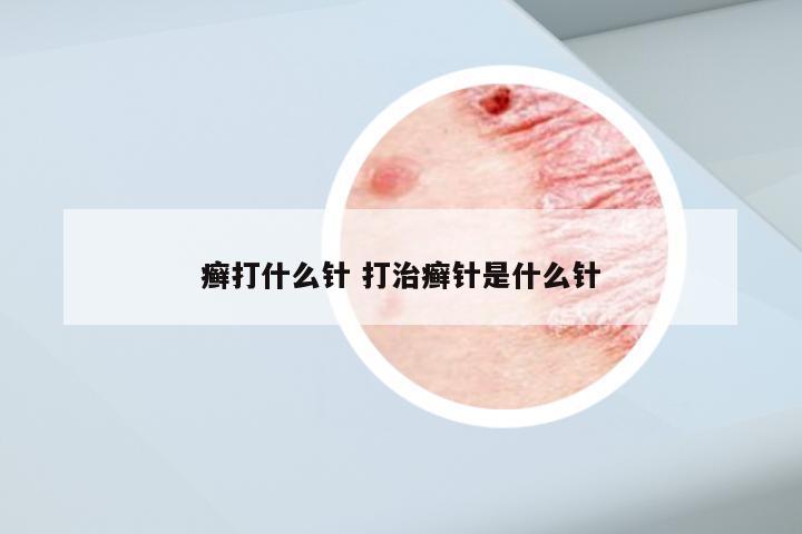 癣打什么针 打治癣针是什么针