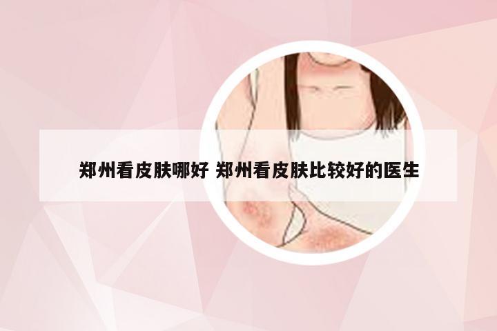 郑州看皮肤哪好 郑州看皮肤比较好的医生