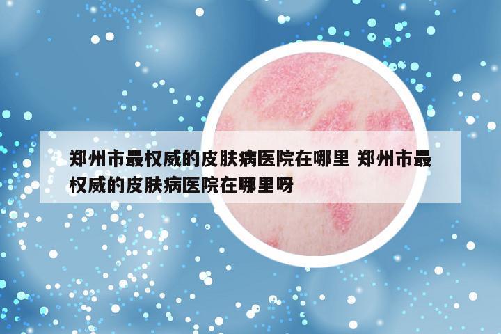 郑州市最权威的皮肤病医院在哪里 郑州市最权威的皮肤病医院在哪里呀