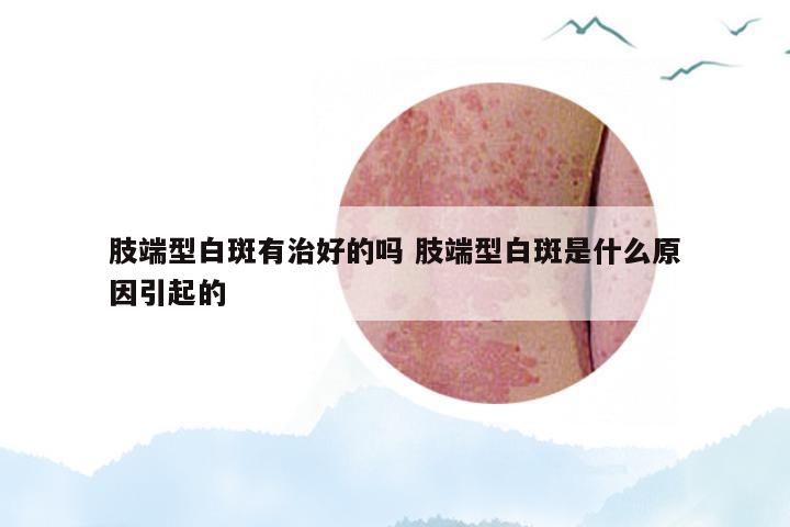 肢端型白斑有治好的吗 肢端型白斑是什么原因引起的