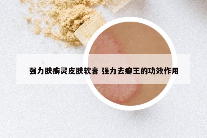 强力肤癣灵皮肤软膏 强力去癣王的功效作用