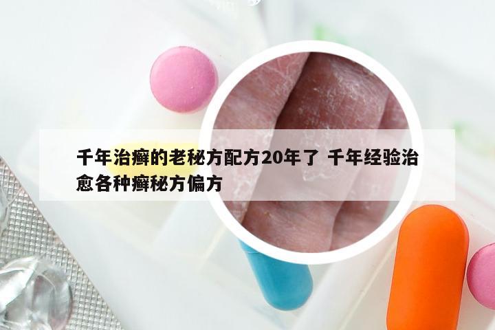 千年治癣的老秘方配方20年了 千年经验治愈各种癣秘方偏方