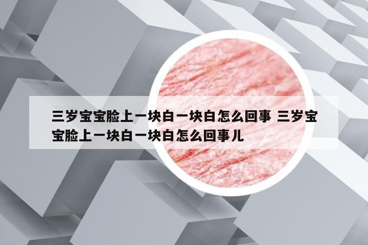 三岁宝宝脸上一块白一块白怎么回事 三岁宝宝脸上一块白一块白怎么回事儿