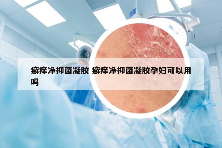 癣痒净抑菌凝胶 癣痒净抑菌凝胶孕妇可以用吗