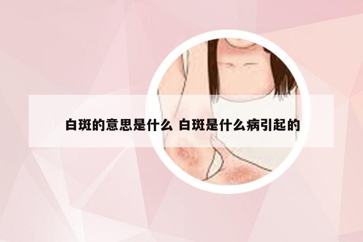 白斑的意思是什么 白斑是什么病引起的