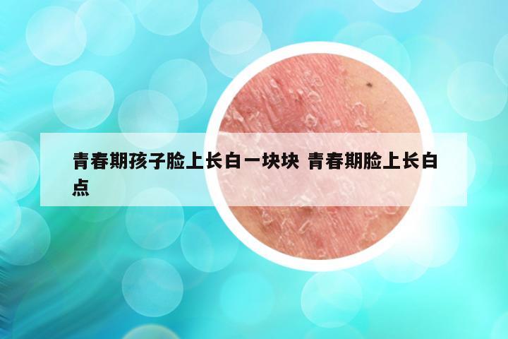 青春期孩子脸上长白一块块 青春期脸上长白点