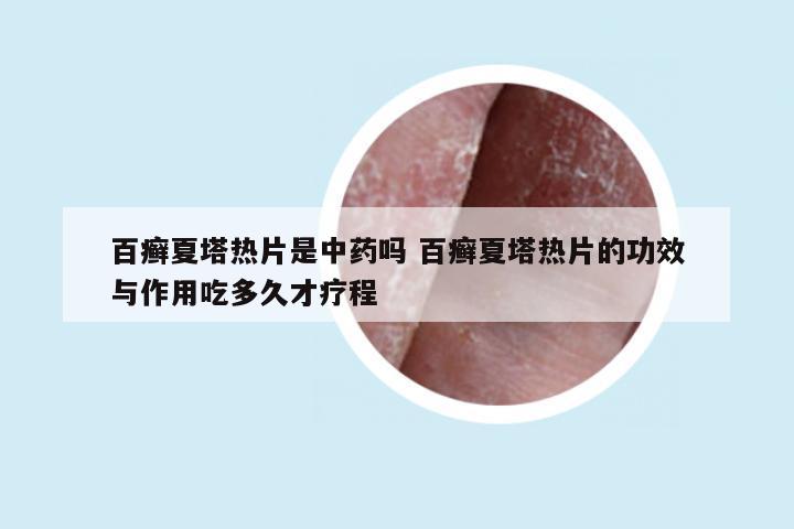 百癣夏塔热片是中药吗 百癣夏塔热片的功效与作用吃多久才疗程