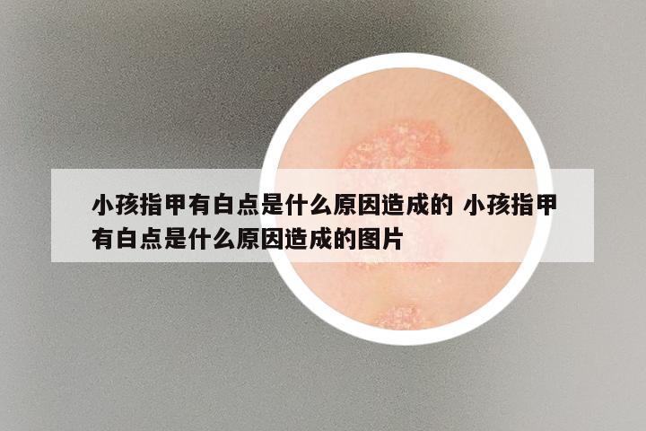 小孩指甲有白点是什么原因造成的 小孩指甲有白点是什么原因造成的图片