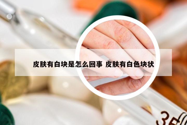 皮肤有白块是怎么回事 皮肤有白色块状