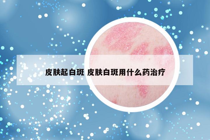 皮肤起白斑 皮肤白斑用什么药治疗