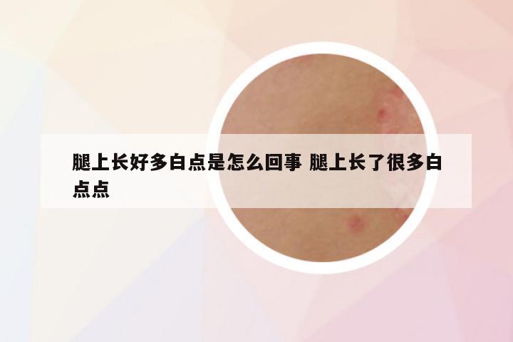 腿上长好多白点是怎么回事 腿上长了很多白点点